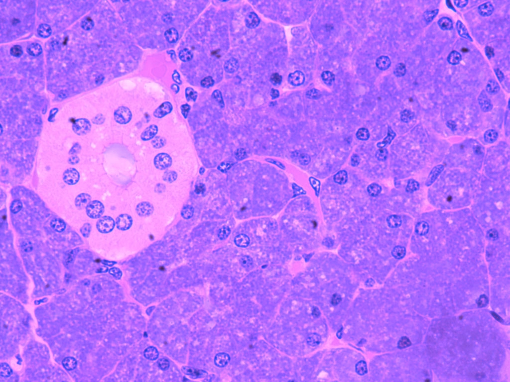 Rough Endoplasmic Reticulum Rough Endoplasmic Reticulum